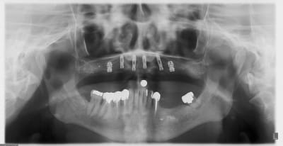 3 mois tzqvfc - Eugenol