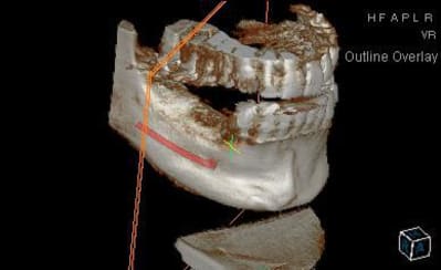 3d1 yguxpd - Eugenol