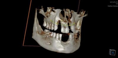 3d5 prdvqs - Eugenol