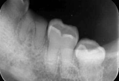 405399a3 cf02 4879 a549 5c8b6158e26b jozk2u - Eugenol