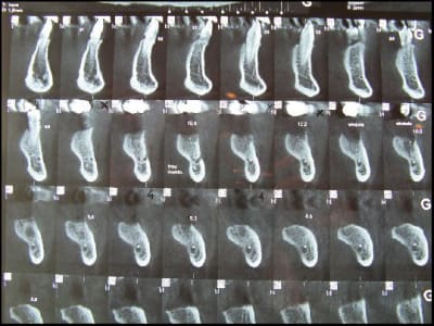 4228bis zeckxd - Eugenol