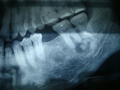 425 atvnct - Eugenol