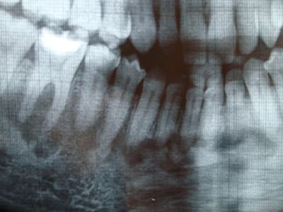 426 vwjsjv - Eugenol