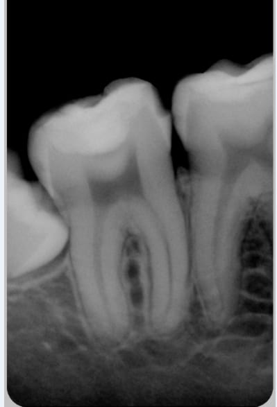 46 47 48 cvohnm - Eugenol