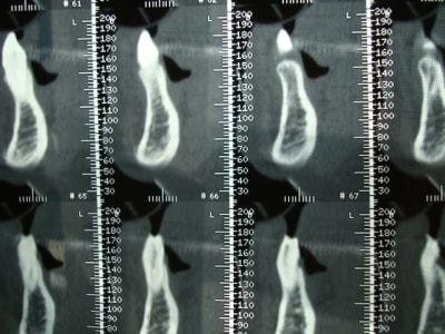 470 gire7s - Eugenol
