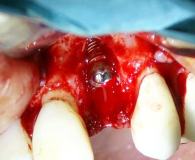 4 bis tbgxvk - Eugenol