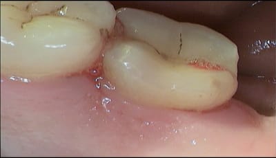 51pop7a6344jbck167oev0tokobv - Eugenol