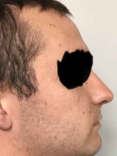 780581f7 855e 4bfa 8613 66d779c84307 rrwohx - Eugenol