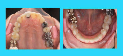 7 t4njtd - Eugenol