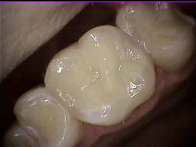 8 26 ap zzlqb2 - Eugenol