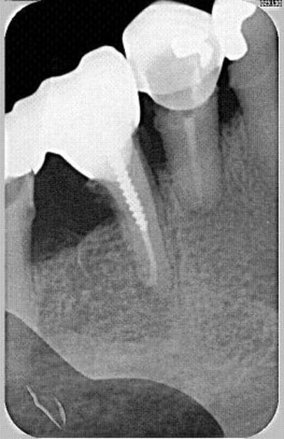 8 ans ocbozp - Eugenol