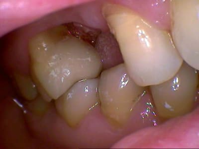 970 cedi1a - Eugenol