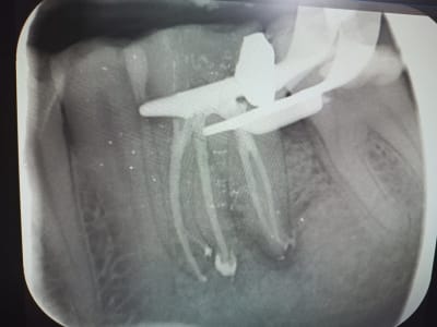 98kgldl8cnb05nhs0bxt0epaf6a4 - Eugenol