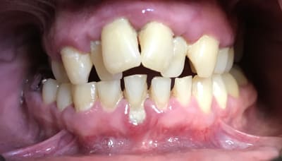 9906b8cf b6a8 436f 9594 91829855c569 avudel - Eugenol