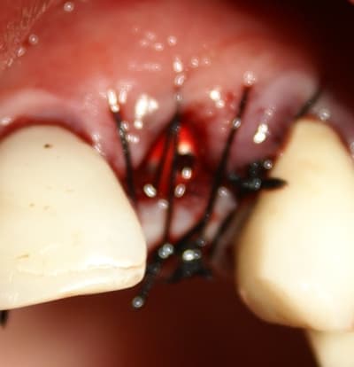 9 bis blfjpf - Eugenol