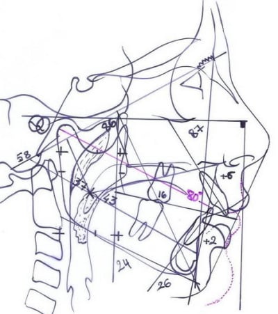 9 udm1qj - Eugenol