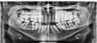 9m8dr6odjun4xiw53mqflglfmxa4 - Eugenol