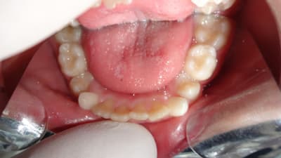 A17 rd6wrb - Eugenol