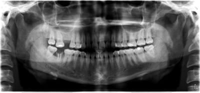 A4edit2 zqug91 - Eugenol