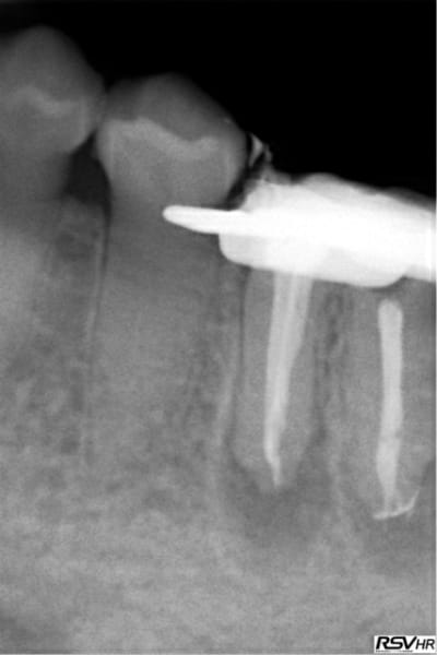 Al3 wvoq1h - Eugenol