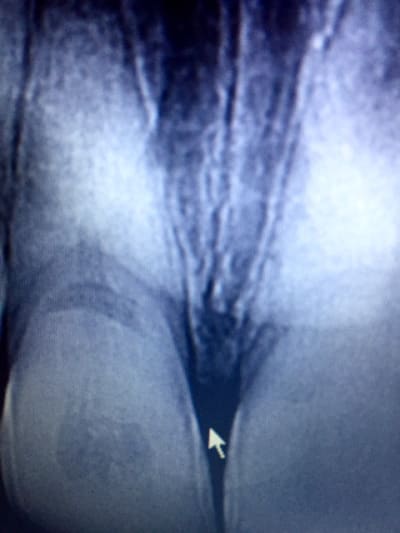 Alex cfaoo6 - Eugenol