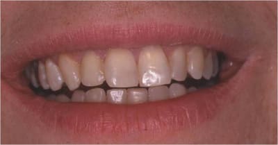 Apr s cuer7q - Eugenol