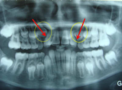 Attention canines 2 woo8sv - Eugenol