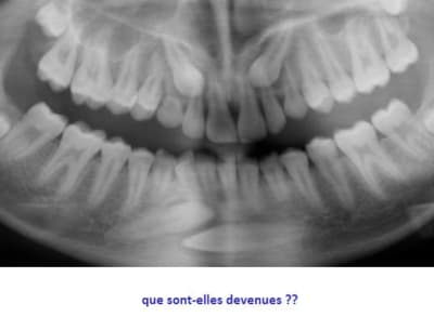 Au fait .. - Eugenol