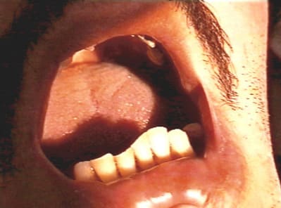 Avant bas nqyol7 - Eugenol