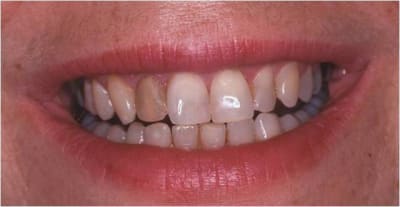 Avant jmabz9 - Eugenol