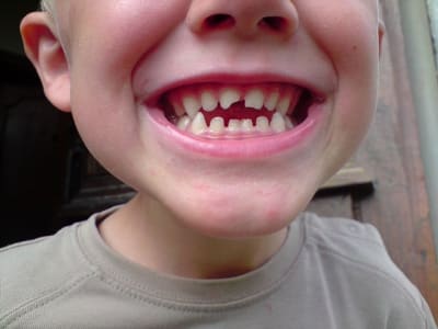 Axl rire 1 m5nvop - Eugenol