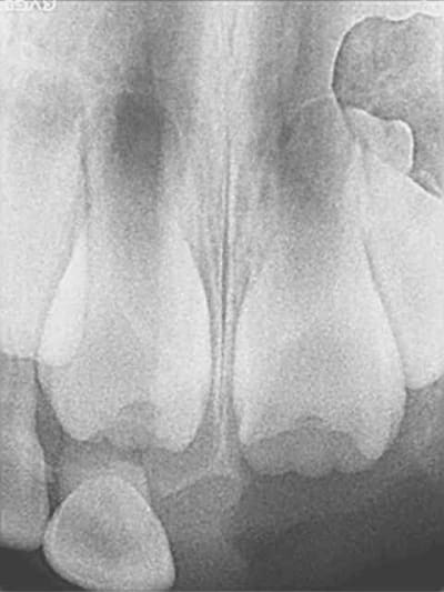 Bb 2004 ju4tlm - Eugenol