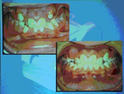 Bouche 1 ijyv5m - Eugenol