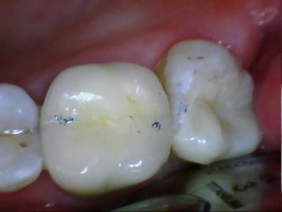 Belott 20120220 4 5 - Eugenol