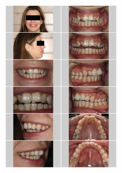 Bilan photo vxbonr - Eugenol