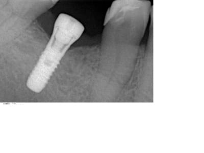 Camp3 dsfphp - Eugenol