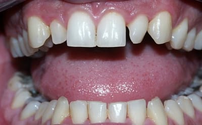 Cccpréop1 bossld - Eugenol