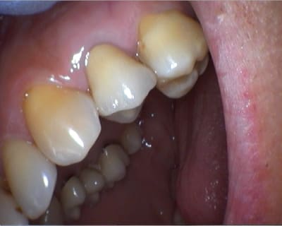 Ccm 24 vestibulaire dfvhxg - Eugenol