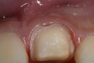 Crw 0559  large  j0jieo - Eugenol
