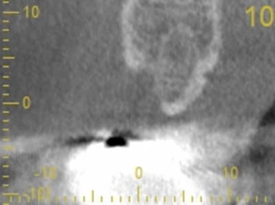 Cs 20131209 0838 10 lanu6v - Eugenol