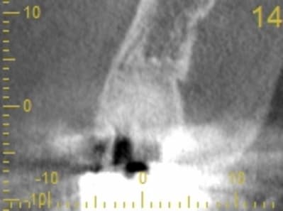 Cs 20131209 0838 14 actgdt - Eugenol