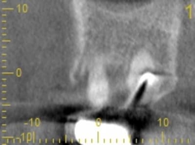 Cs 20131209 0838 1 qyenfh - Eugenol