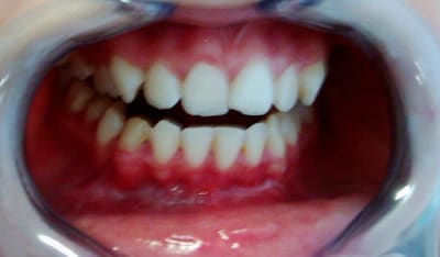 C dsci0020 neluy2 - Eugenol