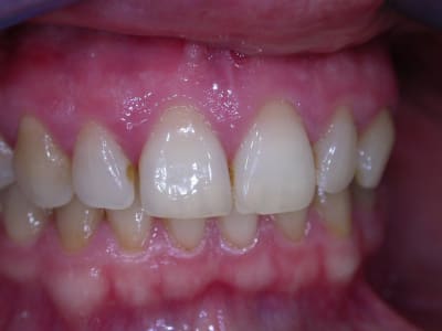 C dscn1687 snmnqr - Eugenol