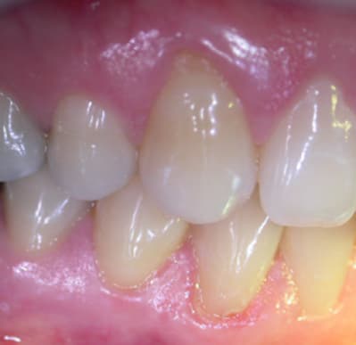 C dscn2287 mvwwnj - Eugenol