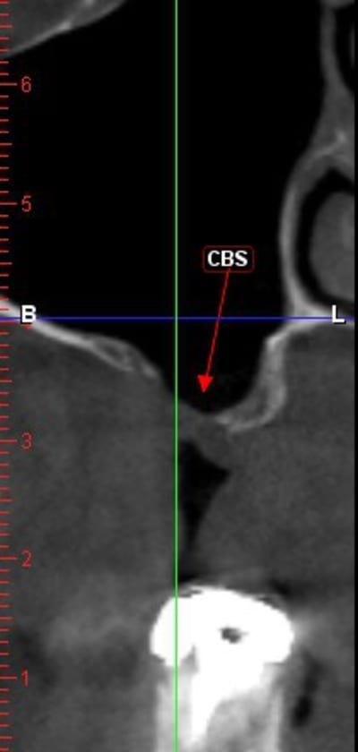 Capt 1957337 h0muvi - Eugenol