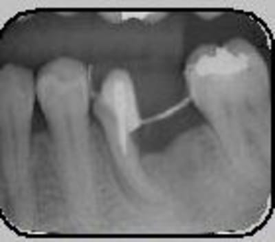 Capture1 buacbf - Eugenol