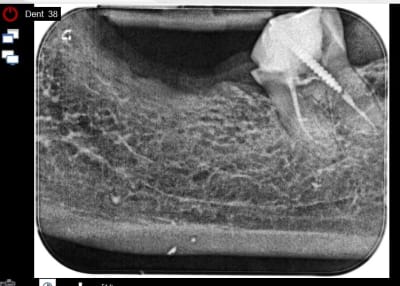 Capture2 ouoo8z - Eugenol