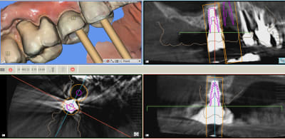 Capture d écran 2018 02 10 à 22.47 - Eugenol