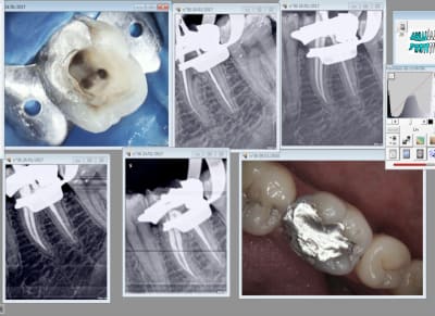 Capture d écran 2017 01 24 20.01 - Eugenol